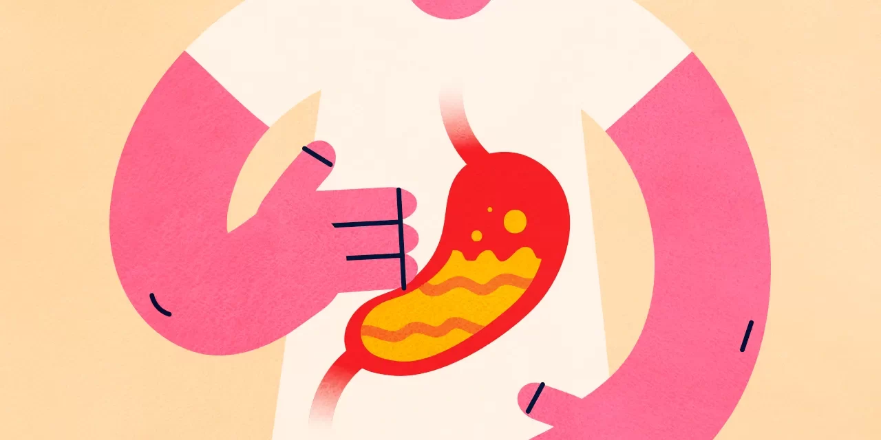 Are Heartburn and Acid Reflux the same?